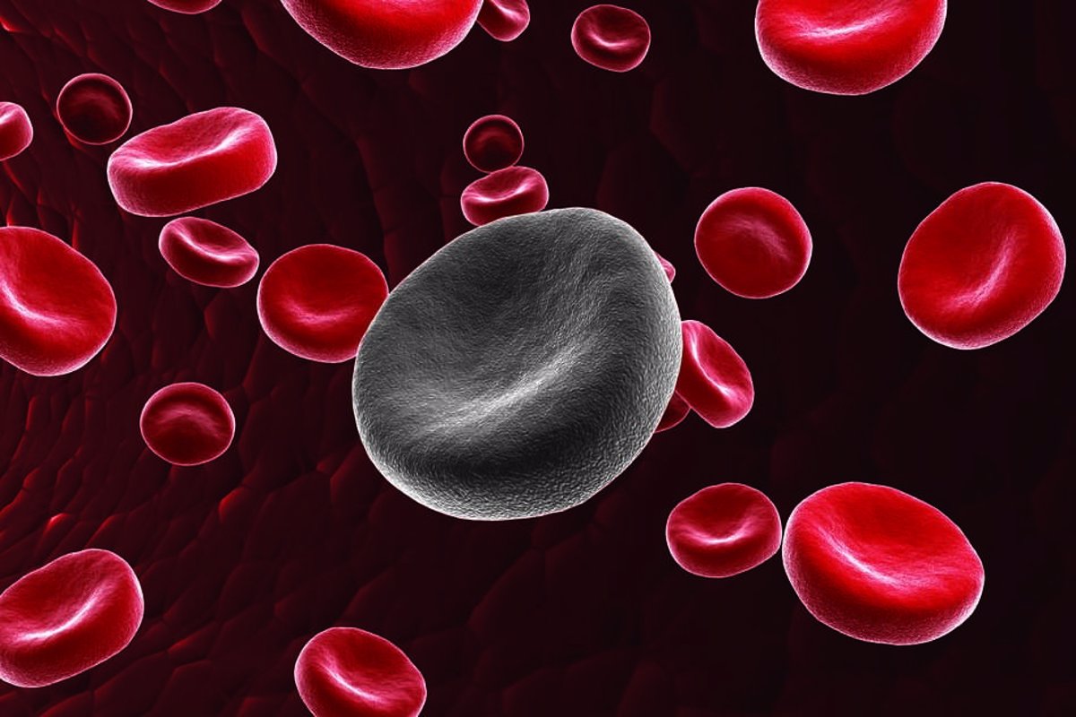 Avances Esperanzadores: Innovadora Terapia Inmunitaria Contra la Leucemia