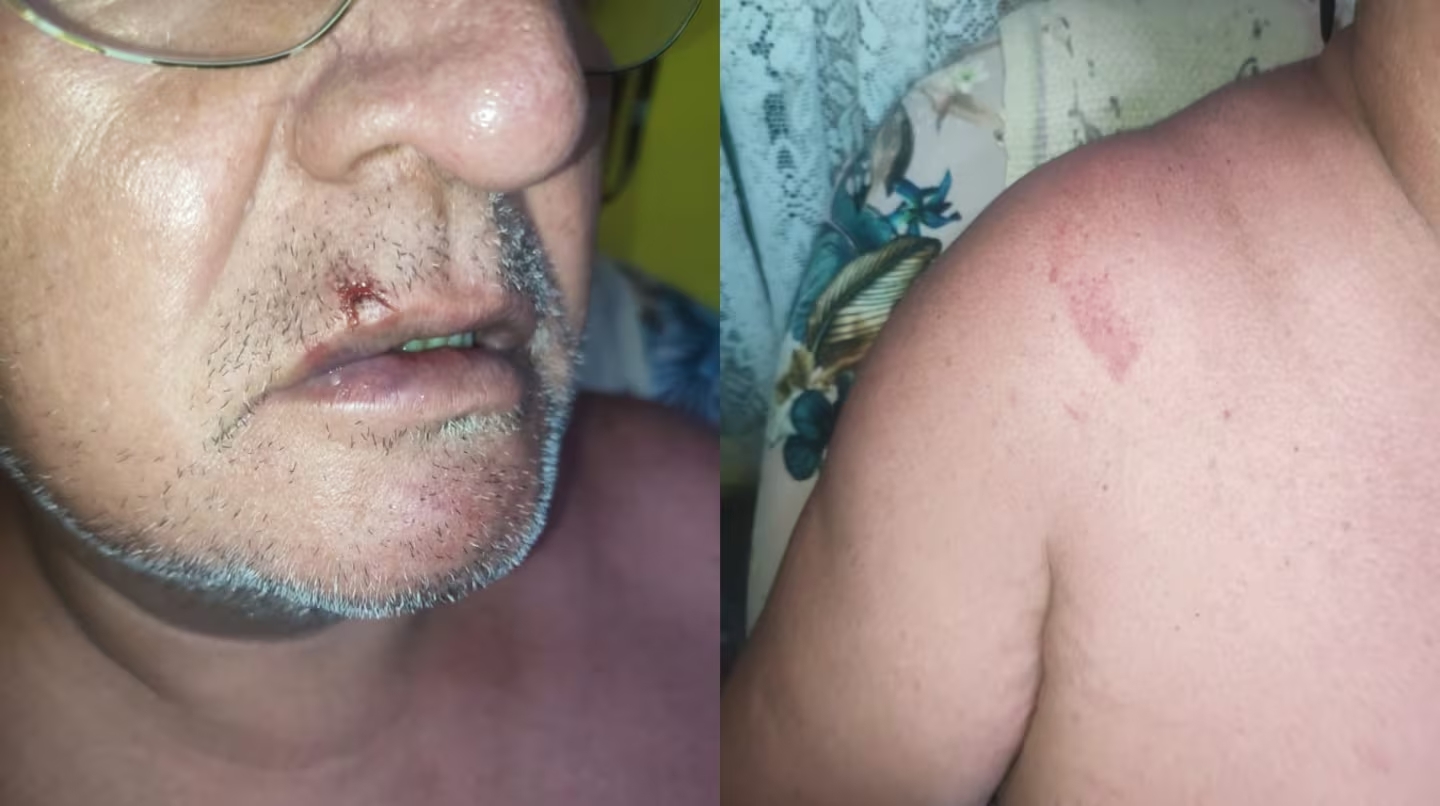 La angustia del turista que se agarró a piñas con cuatro guardavidas en Chubut: “No quiero salir a la calle”